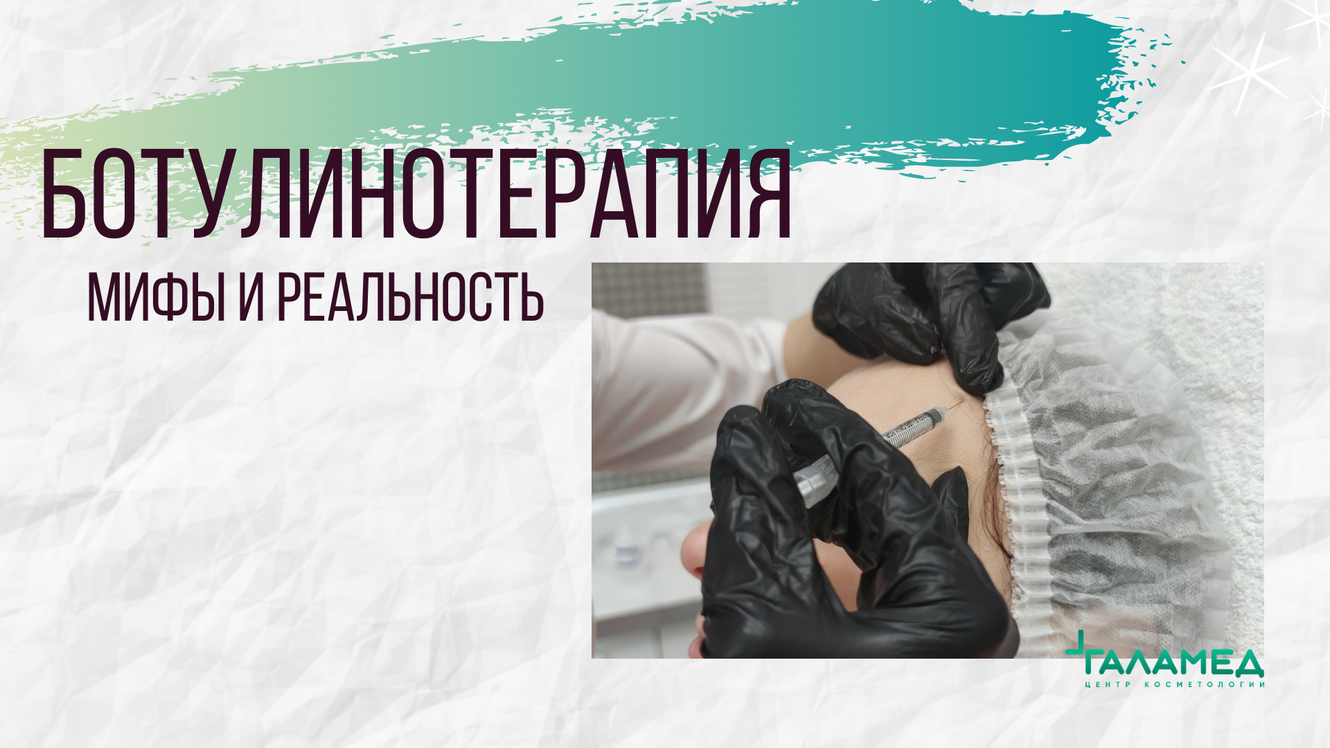 Ботулинотерапия. Мифы и реальность