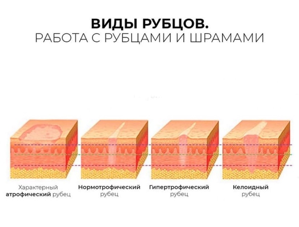 W8IQKkInR6Y.jpg