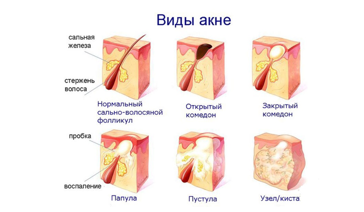 Без имени 2.png Без имени 2.png