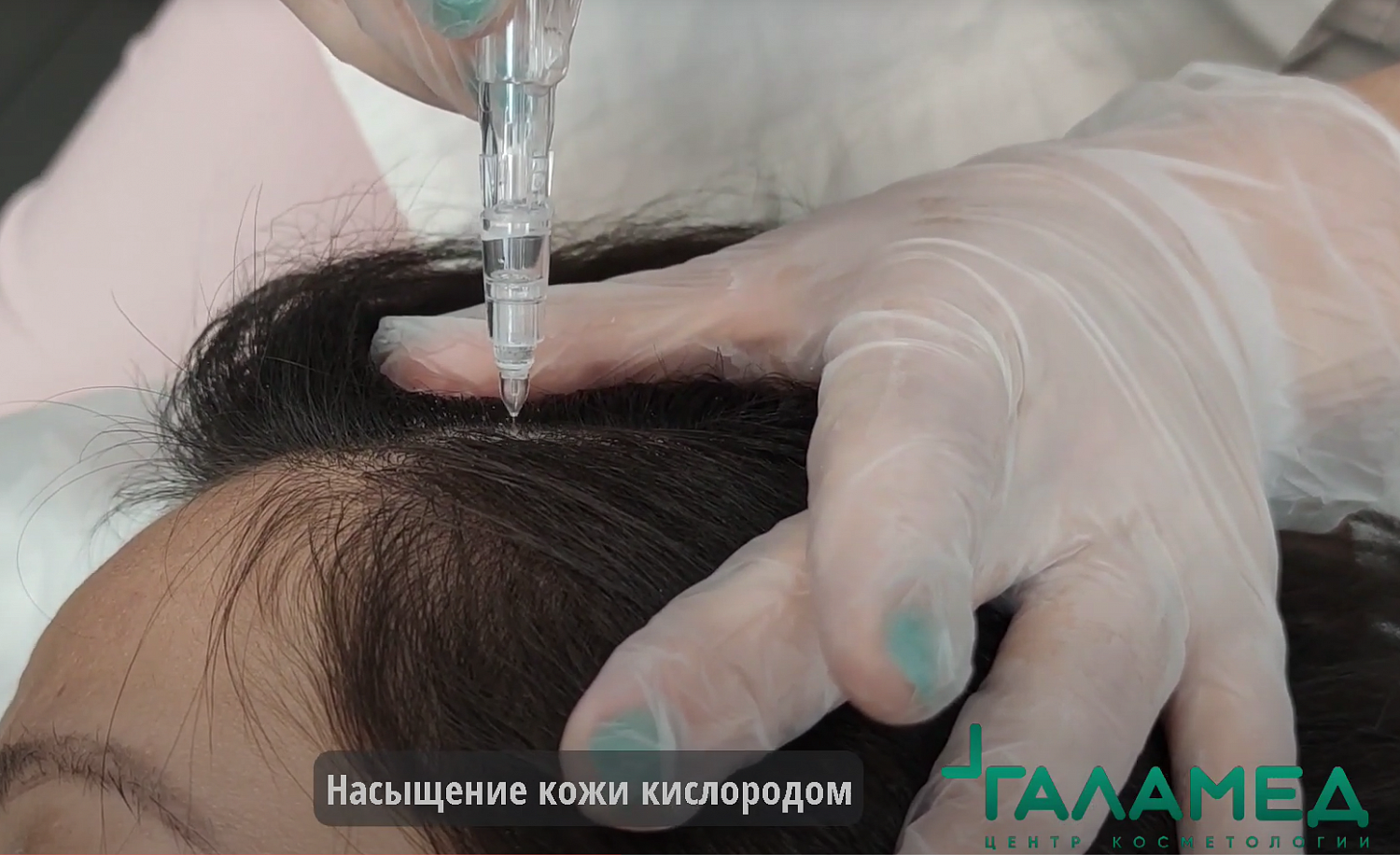 Процедуры от выпадения волос в салонах для женщин и мужчин